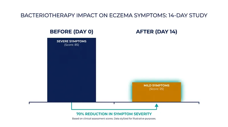 Clinical trials show significant reductions in eczema severity following the application of beneficial commensal bacteria.