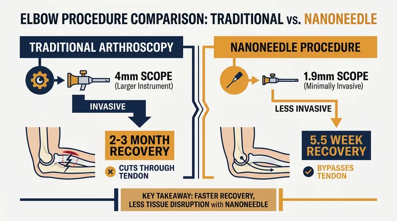 The miniaturized NanoNeedle allows surgeons to bypass the triceps tendon, drastically reducing recovery time.