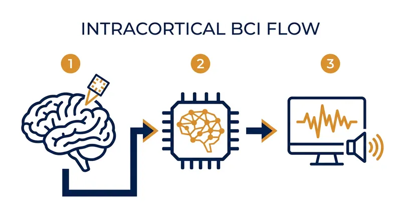 How a BCI translates attempted speech into digital communication.