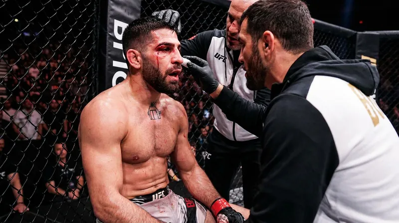 Topuria's corner made the crucial decision to stop the fight, prioritizing his long-term health over the championship.