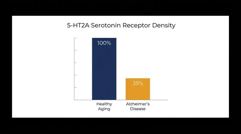 Alzheimer's disease is characterized by a significant reduction in 5-HT2A serotonin receptors, the primary target of psilocybin.