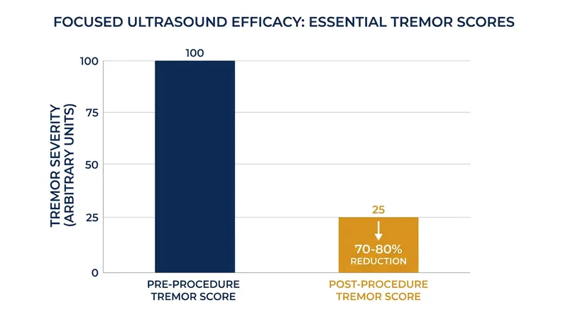 Clinical trials demonstrate an average 70 to 80 percent reduction in hand tremors immediately following the procedure.