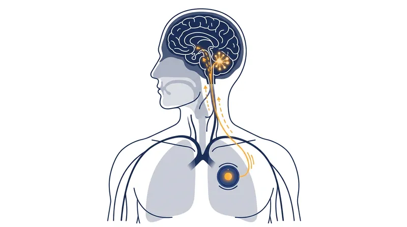 The implant sends calibrated electrical pulses up the vagus nerve to stimulate mood-regulating centers in the brain.