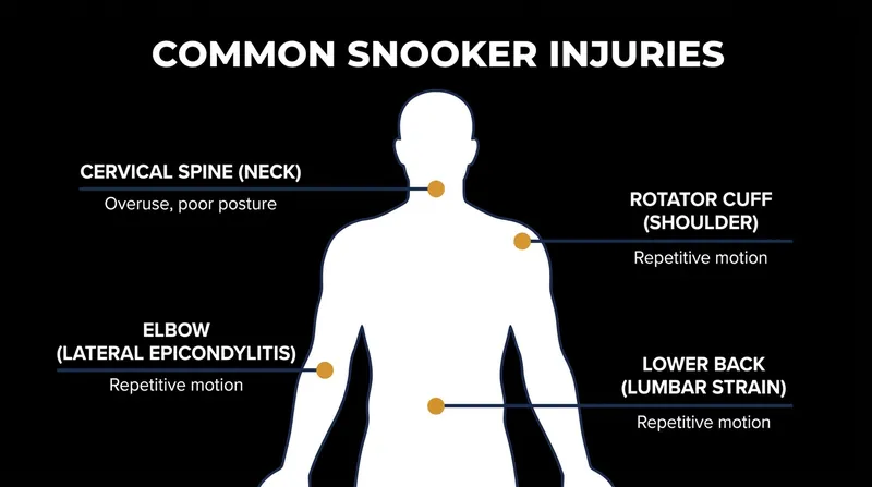 The repetitive strain of snooker places immense pressure on the neck and shoulders.