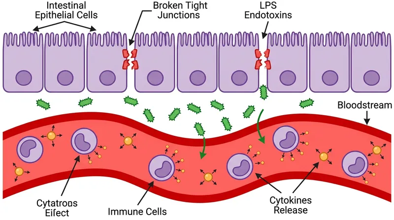 Ischemic stress causes tight junctions to fail, allowing bacterial endotoxins to enter the bloodstream.