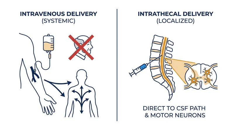 Intrathecal delivery bypasses the blood-brain barrier, allowing the gene therapy to reach motor neurons without requiring a massive, system-wide viral load.