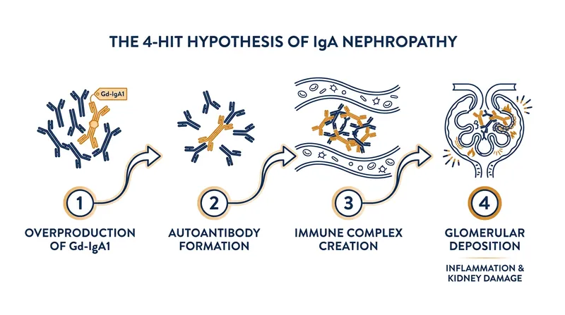 The biological cascade that drives IgA Nephropathy begins with the overproduction of a misshapen antibody.