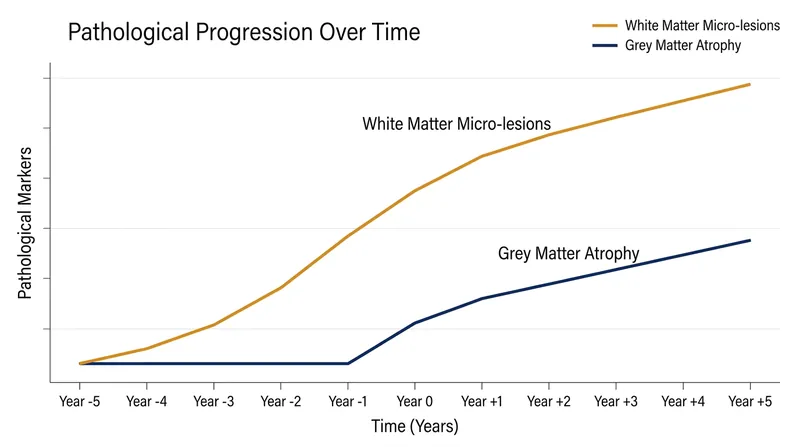White matter degradation precedes measurable grey matter damage by three to five years, offering a new window for early intervention.