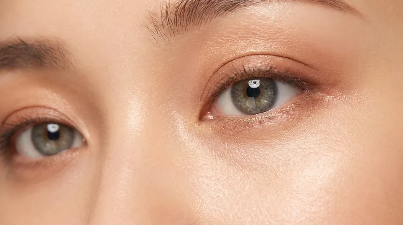 The modern aesthetic ideal favors subtle, rested naturalism over dramatic surgical changes.