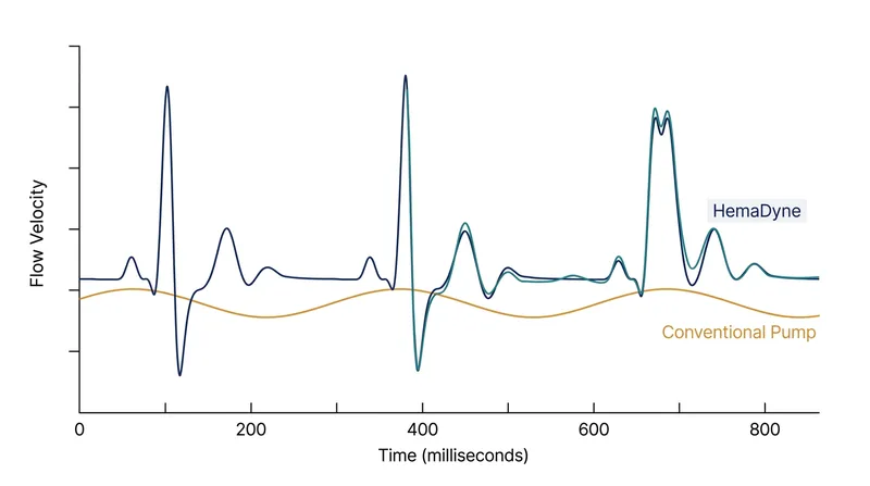 HemaDyne is the first microfluidic pump capable of replicating the transient forward and backward flows of a real heartbeat.