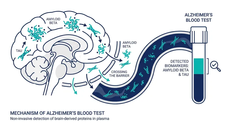 The test measures the ratio of amyloid beta and p-tau217 proteins that spill from the brain into the bloodstream.