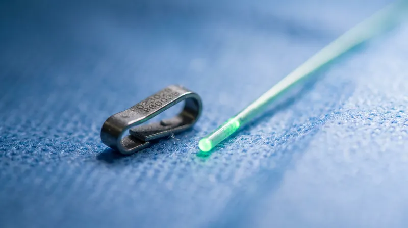 The proprietary titanium clip and excimer laser catheter replace the need for traditional surgical needles and thread.