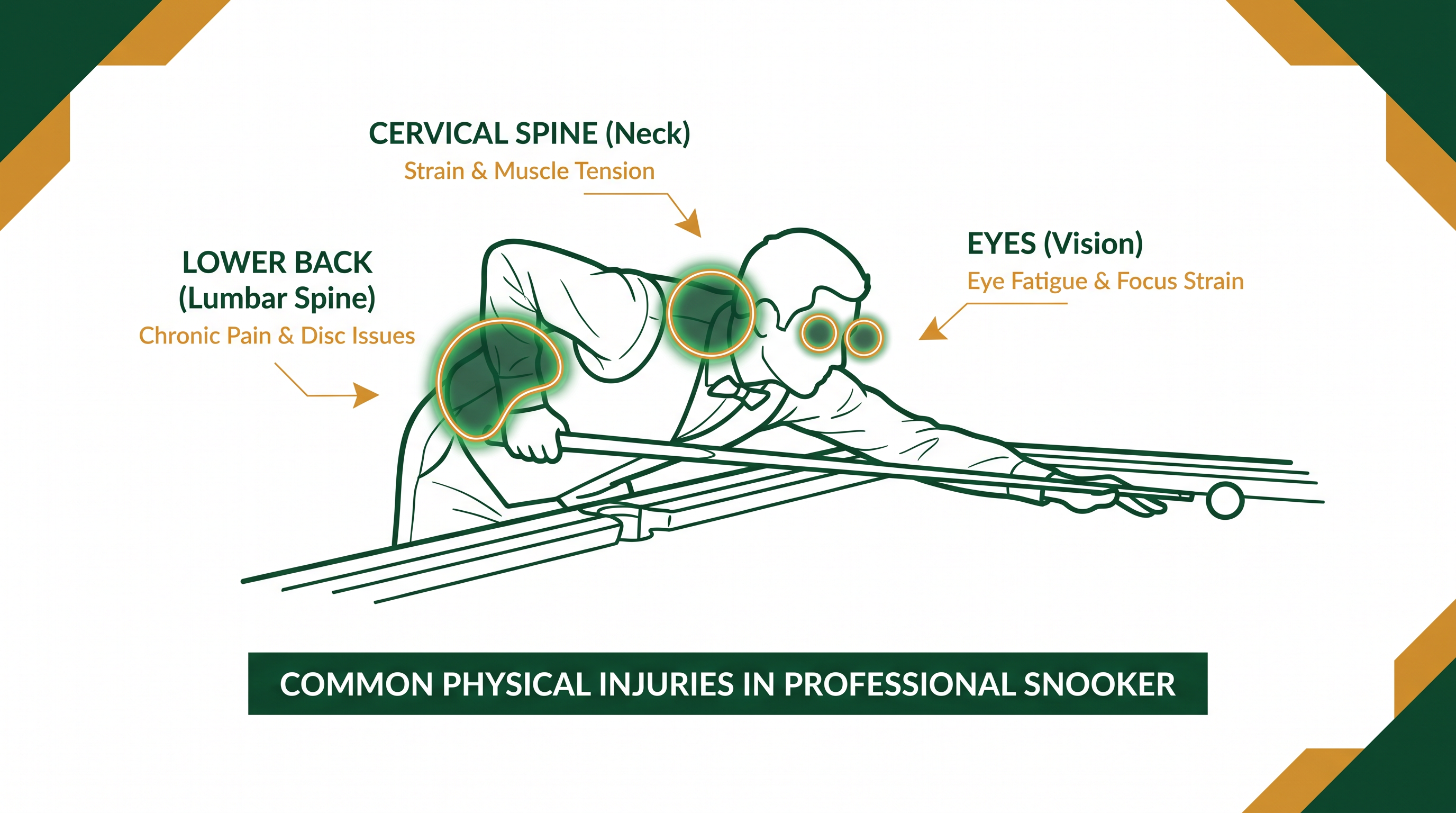 Common physical stress points for professional snooker players.