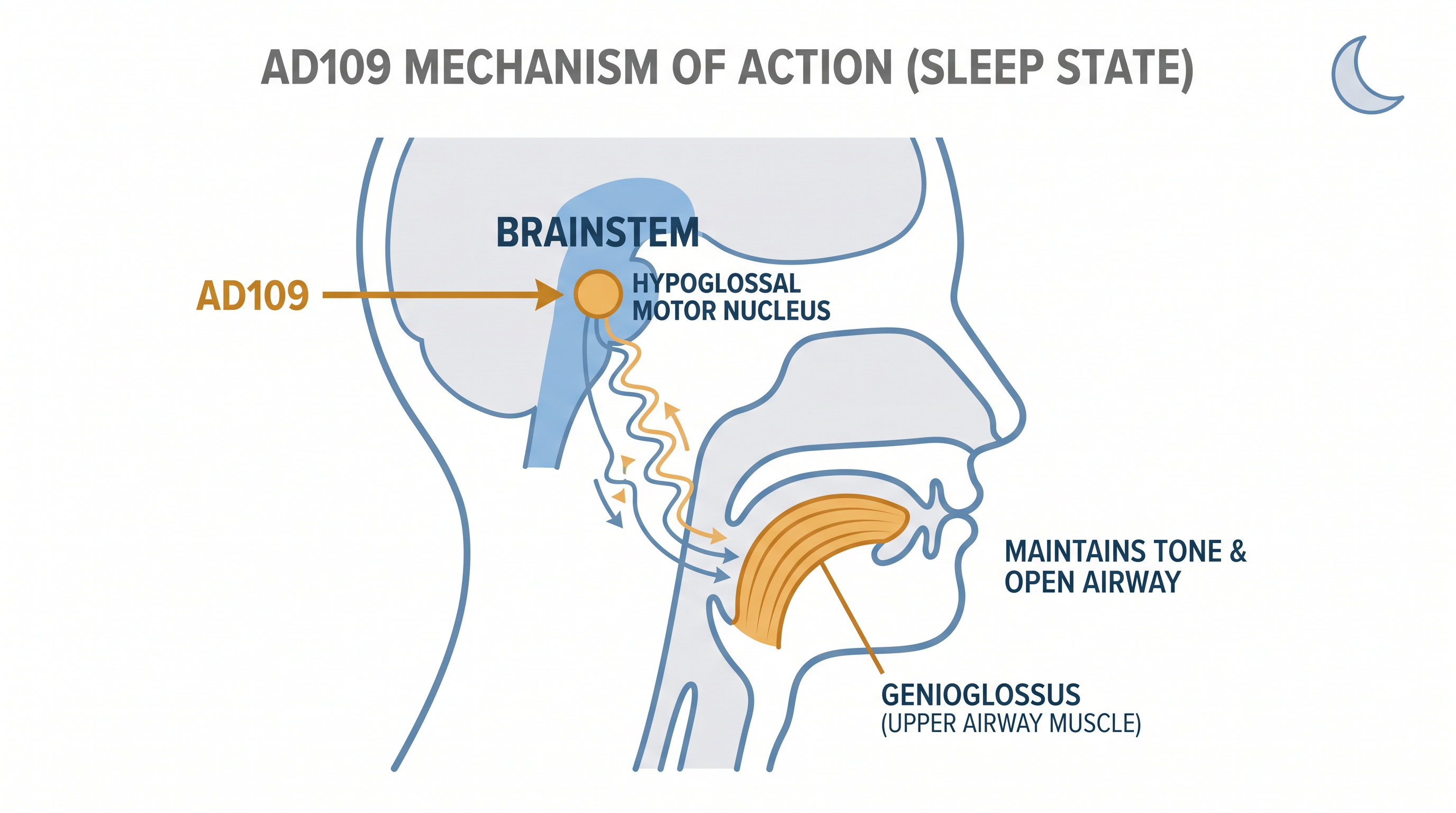 AD109 works by stimulating the hypoglossal motor nucleus, which maintains muscle tone in the upper airway during sleep.