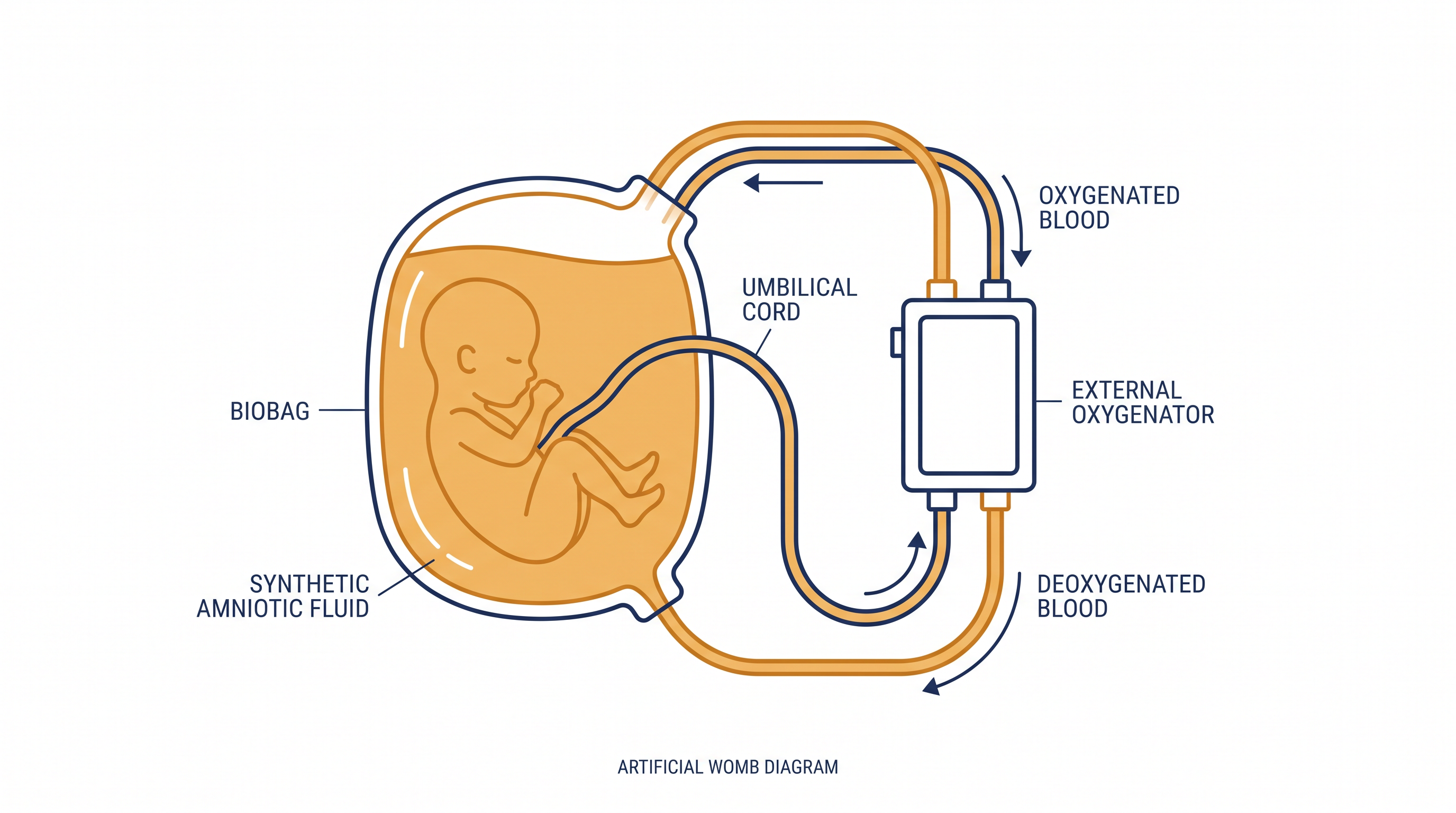 Unlike conventional incubators, artificial wombs submerge the infant in fluid and use the umbilical cord for oxygen exchange.
