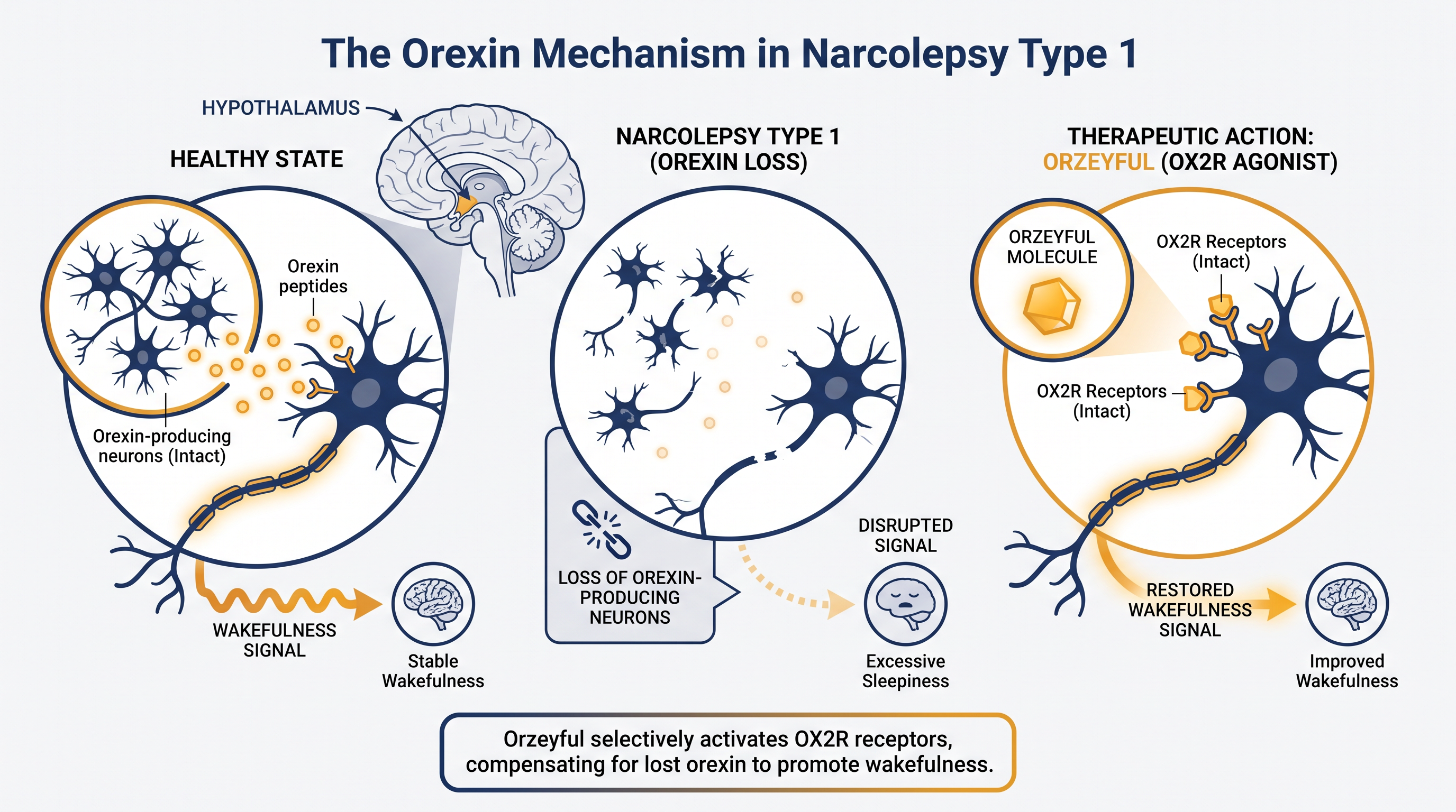 By binding to intact OX2R receptors, Orzeyful mimics the brain's missing orexin to stabilize the sleep-wake boundary.