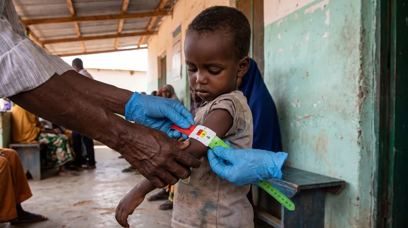 Medical surveys in Baidoa indicate that one in every two children screened is acutely malnourished.