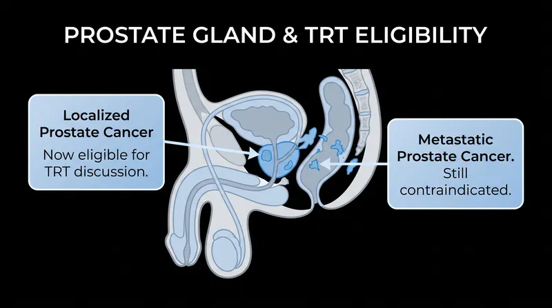 Testosterone therapy is no longer broadly warned against for all prostate cancer patients, only those with metastatic disease.