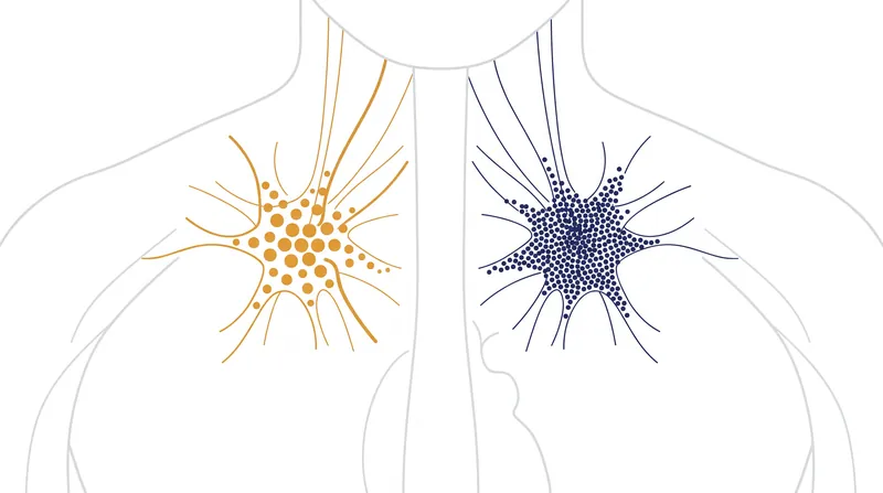 Exercise induces asymmetric neuroplasticity, multiplying neurons on the right side while enlarging existing cells on the left.