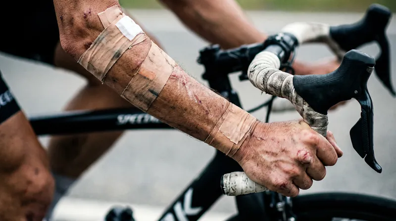 For many riders on the start line, simply overcoming the physical trauma of mid-season crashes is a major victory.