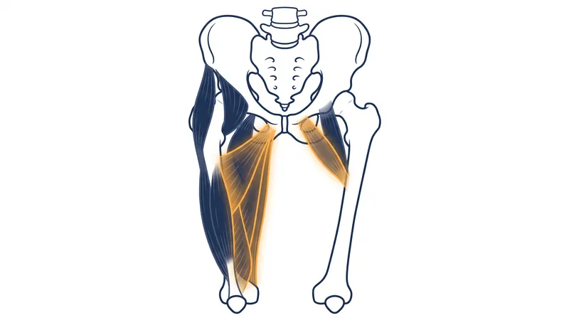 The pectineus muscle in the hip adductor group is heavily strained during the breaststroke whip kick.