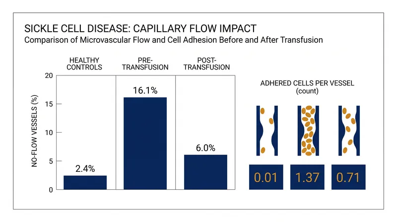 In vivo imaging reveals that while transfusions restore mechanical blood flow, cellular stickiness remains elevated.