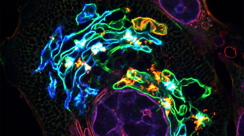 Endoplasmic reticulum (ER) stress is a shared pathway of beta-cell death across multiple forms of diabetes.