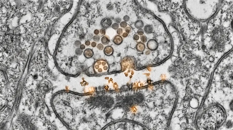 The synaptic cleft measures roughly 20 nanometers across.