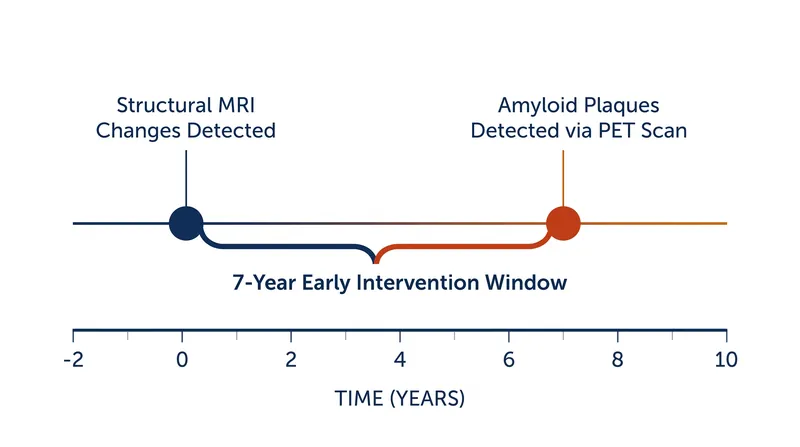 The Oslo study revealed a seven-year gap between structural brain changes and the appearance of amyloid plaques.