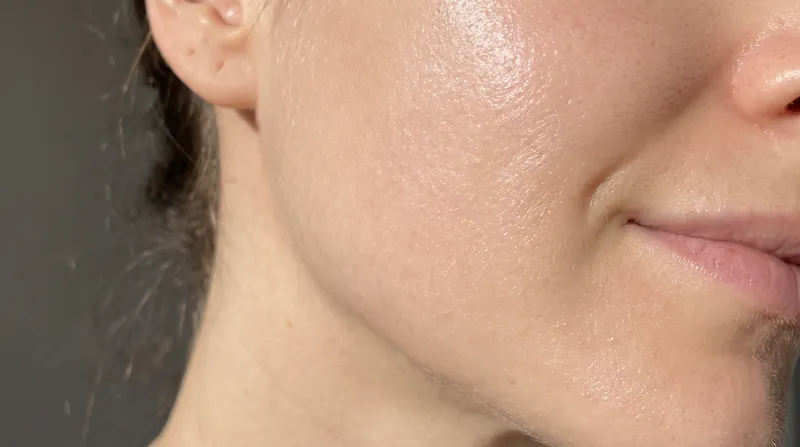 Skin quality—focusing on texture, hydration, and resilience—has become the foundational step in modern aesthetic planning.