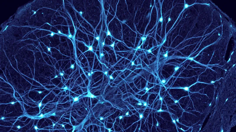 Without nightly pruning, the cortex becomes physically crowded with redundant connections, degrading the signal-to-noise ratio.