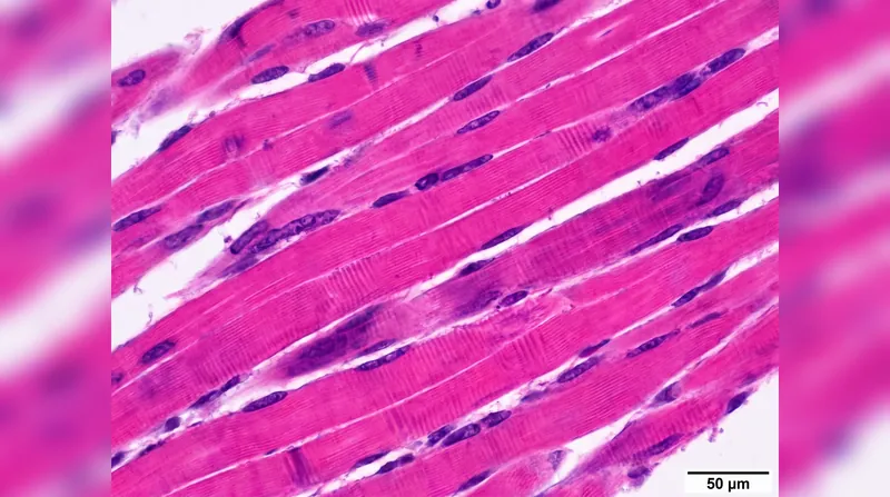 In skeletal muscle, metformin activates AMPK to pull glucose out of the bloodstream independent of insulin signaling.