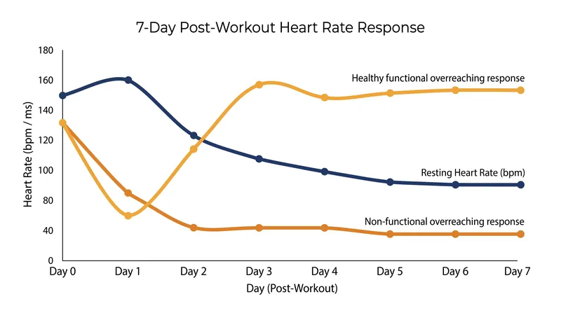 A suppressed heart rate variability score extending past 72 hours is a primary clinical indicator of overtraining.