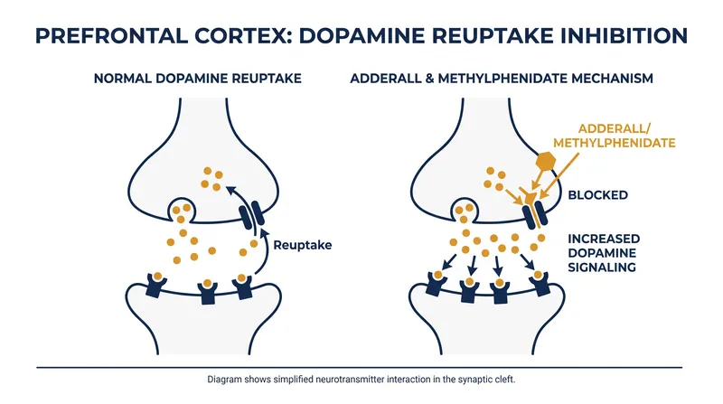 Stimulants block the reuptake of dopamine, flooding the brain's prefrontal cortex to artificially sustain attention.