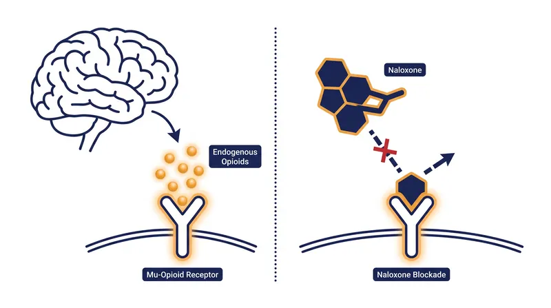 Naloxone blocks the placebo effect by occupying the same receptors that the brain's internal painkillers target.