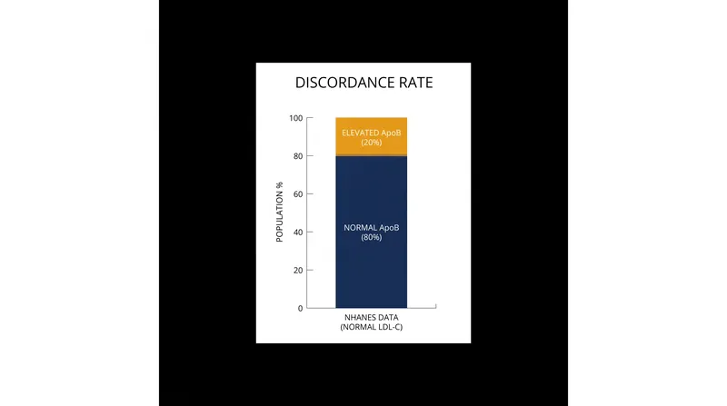 Approximately one in five patients has discordant lipid levels, meaning their standard LDL-C test underestimates their true cardiovascular risk.