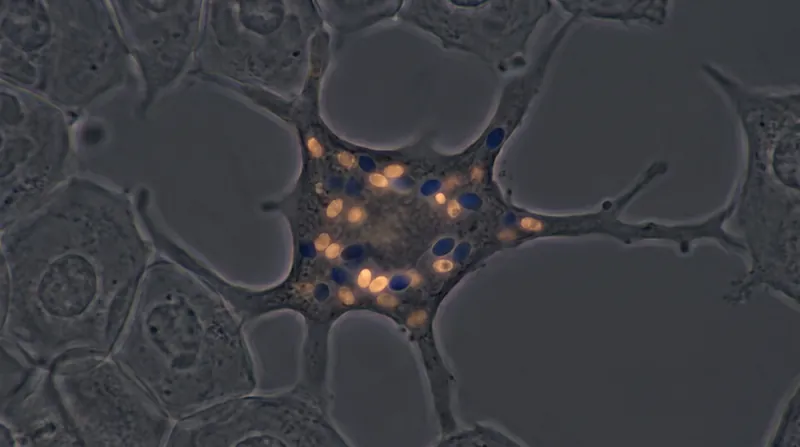Microscopic view of melanocyte cells producing melanin pigment in the epidermal layer.