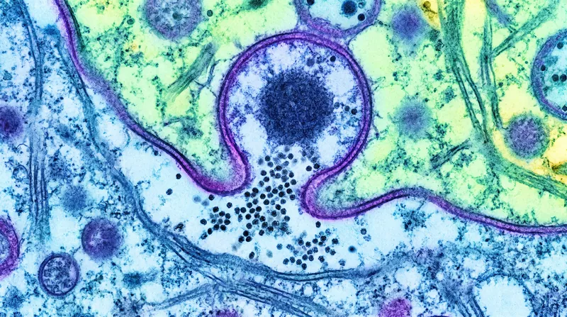 The final twist of the SNARE complex forces the lipid bilayers to merge, opening a microscopic fusion pore.