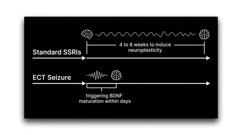 Unlike oral medications that take weeks to build synaptic connections, ECT forces an immediate structural rebuilding response.
