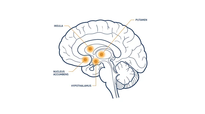 The study identified microstructural differences in regions of the brain responsible for motivation, craving, and hunger regulation.