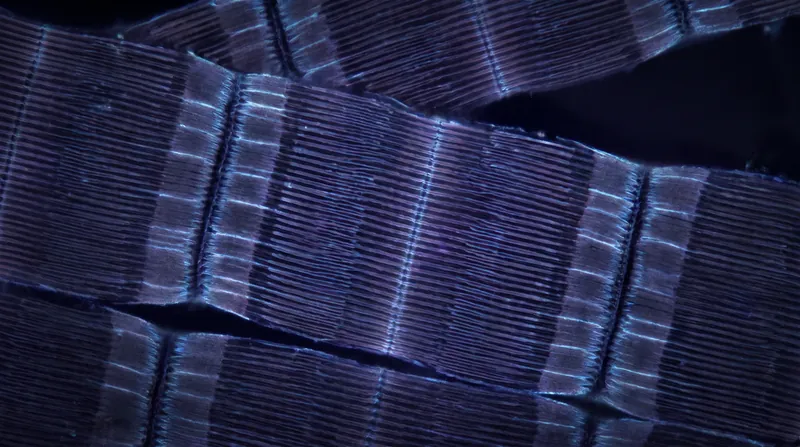 Microscopic view of striated muscle tissue showing the distinct overlapping bands of sarcomeres.