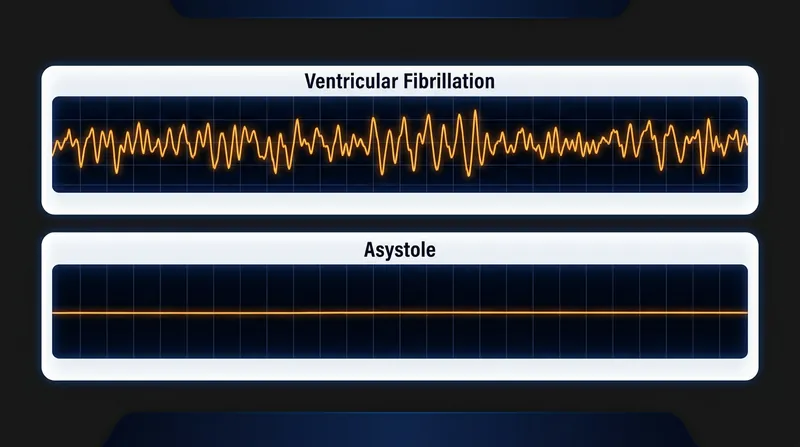 Ventricular fibrillation presents as a chaotic waveform of re-entrant circuits, whereas asystole appears as a flatline devoid of electrical activity.