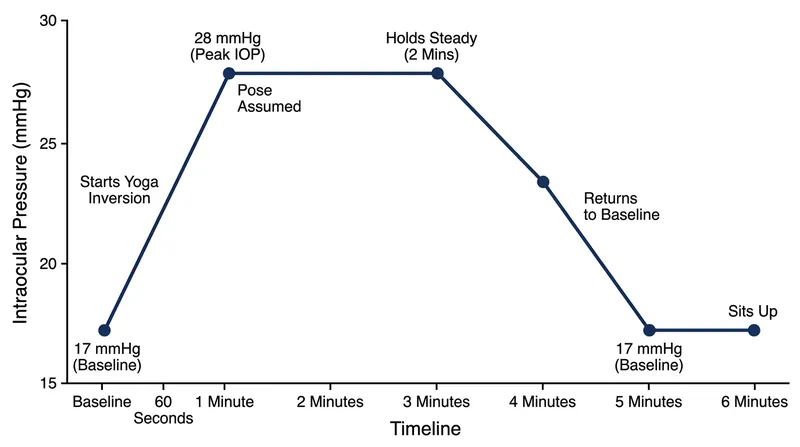 Intraocular pressure surges within 60 seconds of inversion and returns to normal within two minutes of sitting upright.