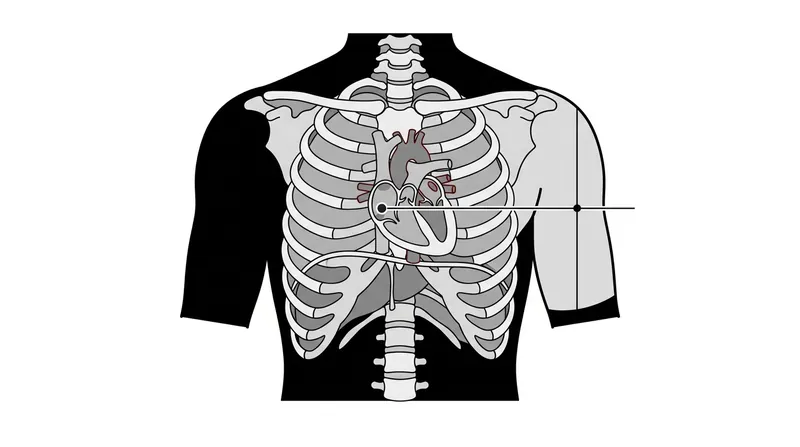 The phlebostatic axis represents the exact level of the right atrium, serving as the zero-reference point for cardiovascular pressure.
