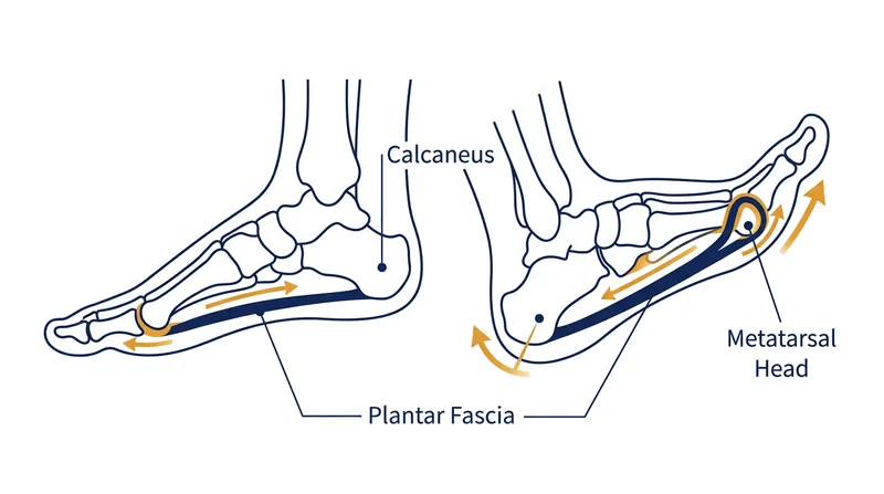 The plantar fascia acts as a mechanical cable, winding around the bones of the forefoot.