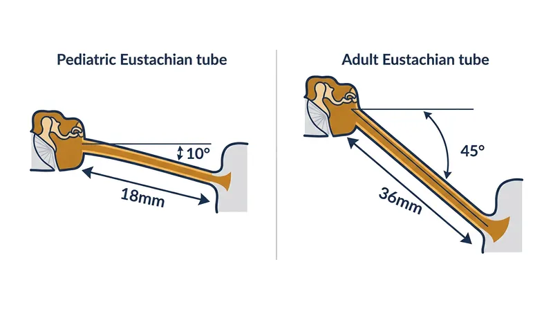A child's Eustachian tube is half the length and significantly flatter than an adult's, eliminating the advantage of gravity.