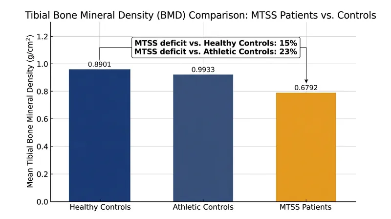 Runners suffering from medial tibial stress syndrome exhibit a significant localized drop in bone mineral density.