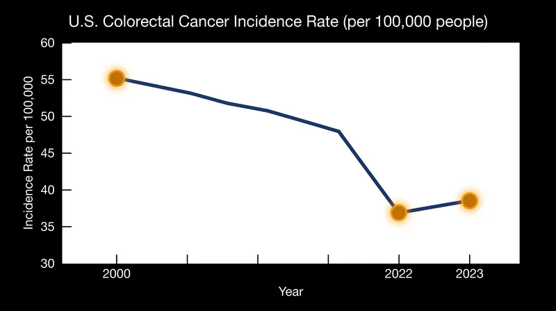 The overall incidence rate of colorectal cancer in the U.S. rose in 2023, ending a two-decade decline.